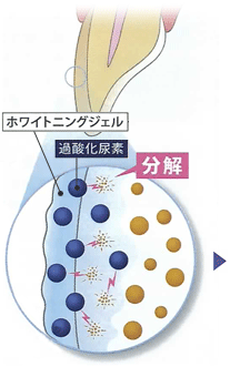 ホワイトニングジェル