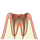 TAKAデンタルクリニック歯画像5