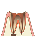 TAKAデンタルクリニック歯画像6